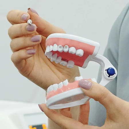 A dental professional holding a model of a mouth