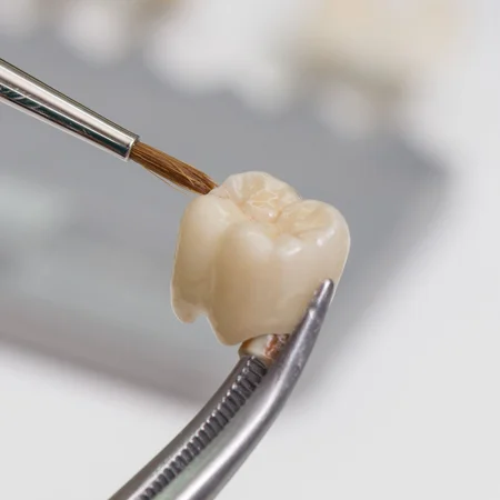 Dental crown held with forceps while a brush applies material.