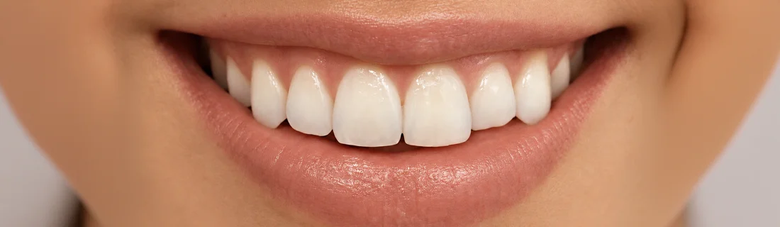 Woman Smiling With Hands By Face
